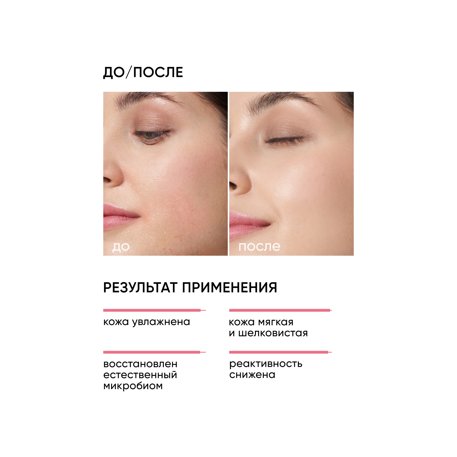 Крем успокаивающий с пробиотическим комплексом Skin Zen купить в VISAGEHALL