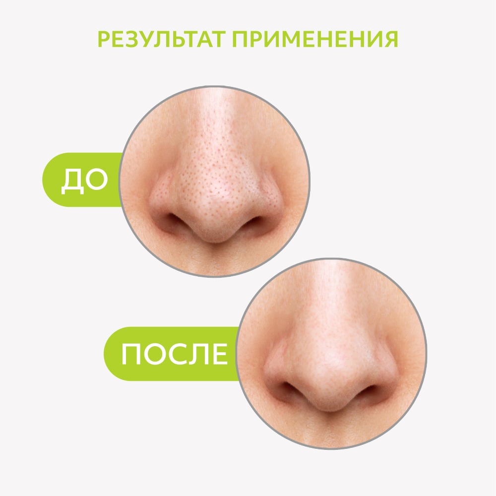 Полоски очищающие для носа для удаления черных точек 6шт купить в VISAGEHALL