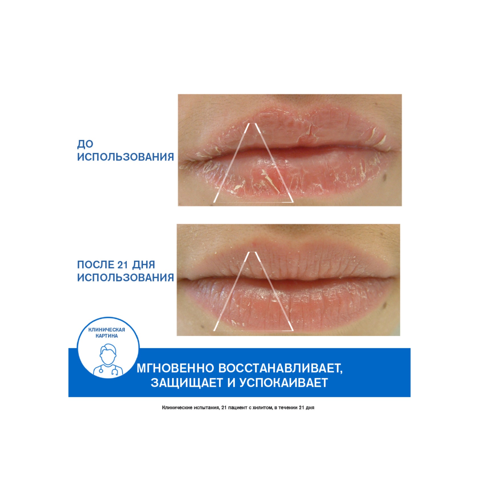 Бальзам-цика для губ Bariederm купить в VISAGEHALL